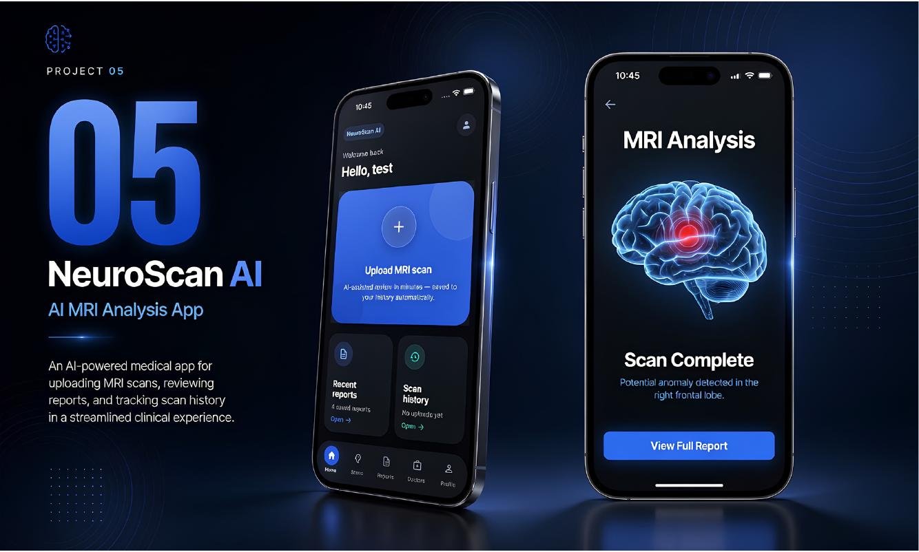 NeuroScan AI app — AI-powered MRI analysis mobile app case study